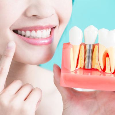 How To Choose The Best Dentist As Per Your Choice?